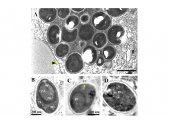 Enterocytozoon hepatopenaei sp. nov. (Microsporida: Enterocytozoonidae)