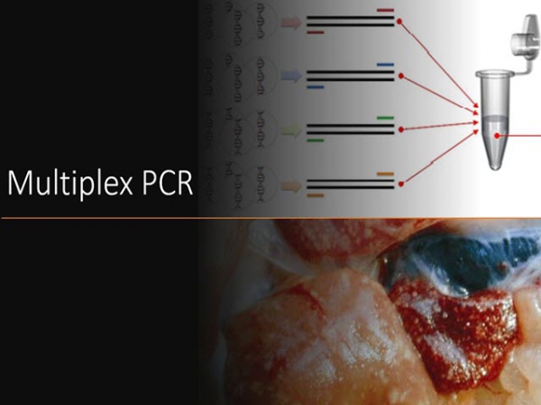 Multiplex PCR - Phát hiện nhanh, chính xác bệnh gan thận mủ